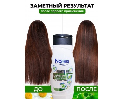 Шампунь NOXES, 380мл для всех типов волос, экстракт АЛОЕ ВЕРА